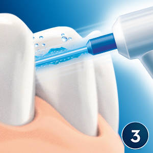 Utilisation de l’hydropulseur Oral-B Waterjet