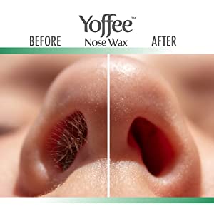 Yoffee Kit de cire de nez rapide facile et indolorekit d'épilation est facile à utiliser vegan 