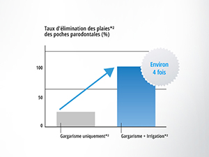 Éliminer la plaque dentaire